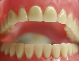 मुफ्त दांत प्रोस्थेटिक्स