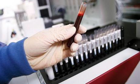 यदि एएलटी और एएसटी ऊंचा हो तो रक्त परीक्षण संकेत क्या होता है?
