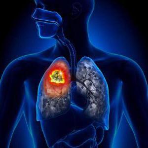 Bronchitis के साथ बच्चों में छत ceftriaxon कितने दिन